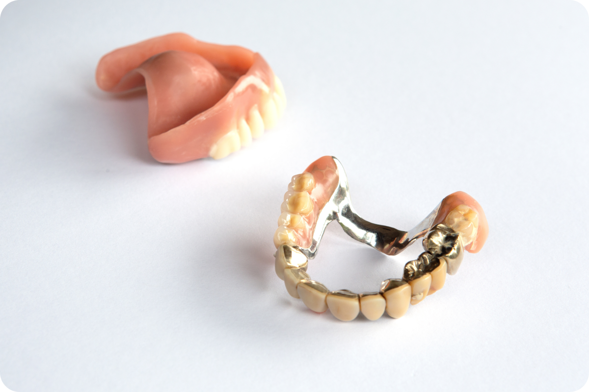 Prothèses dentaires remplaçant des dents manquantes — dentiste Le Beausset