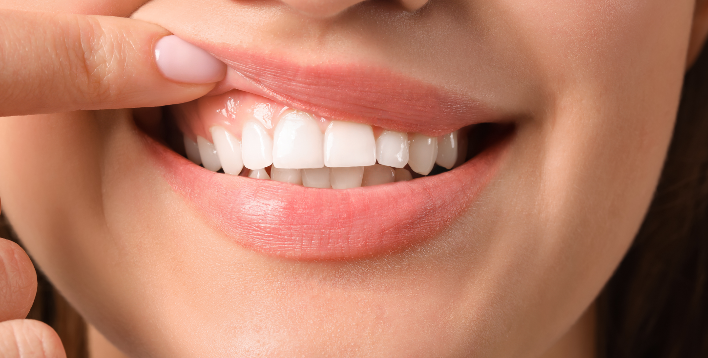 Soin des gencives préservant les tissus de soutien — dentiste Le Beausset