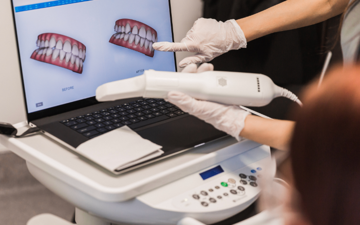Empreinte numérique prise sans pâte d’empreinte — dentiste Le Beausset